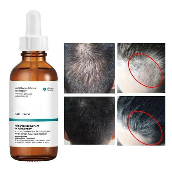 The Ordinary Original Multi-Peptide Serum for Hair Density, 60 ml