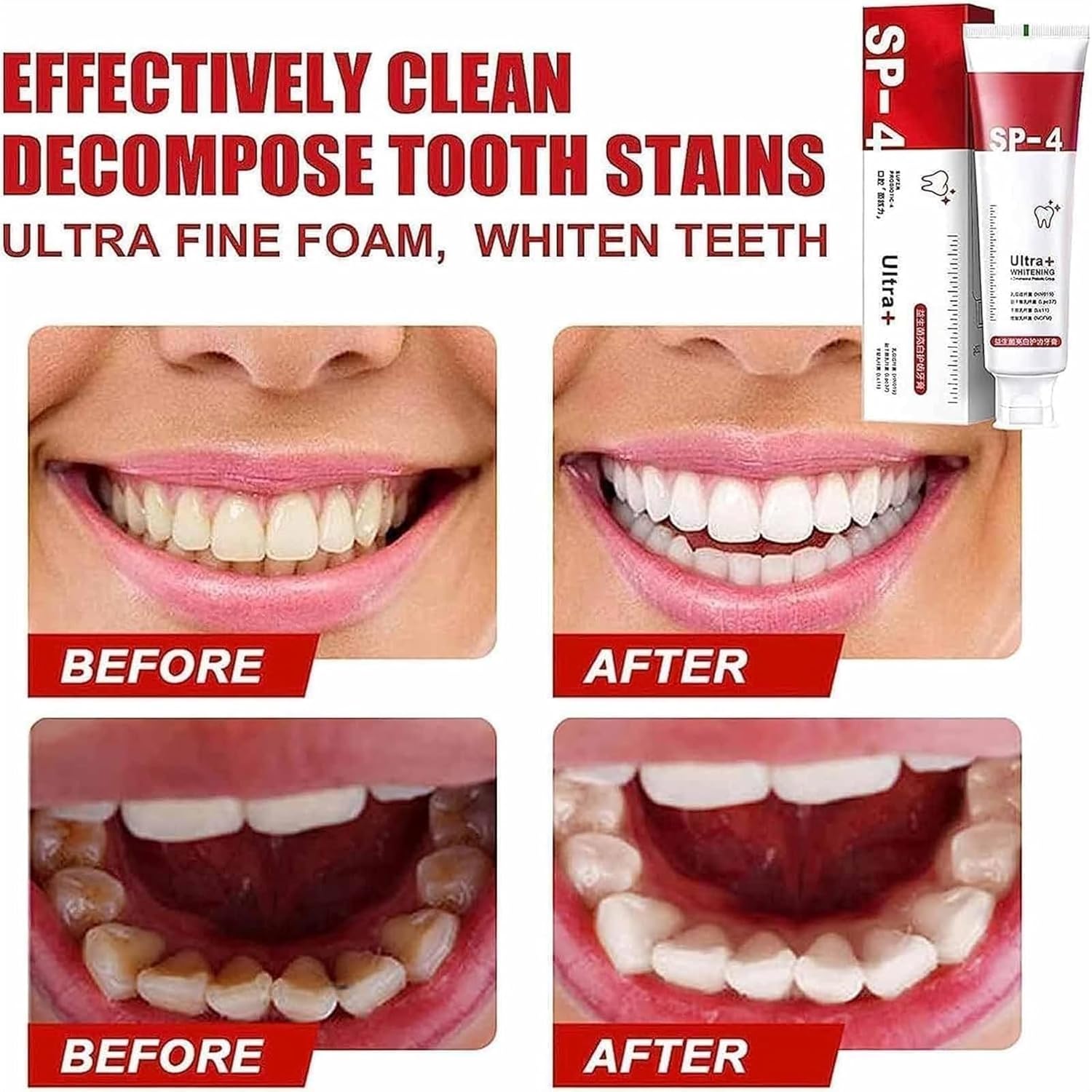 Yayashi Sp-4 Ultra Whitening Toothpaste Probiotic Stain Remover 120Gm /Nano Toothbrush Protects Gums Freshens Breath, for Everyone - Image 4